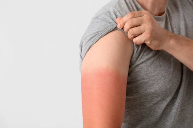 Hand De-tan